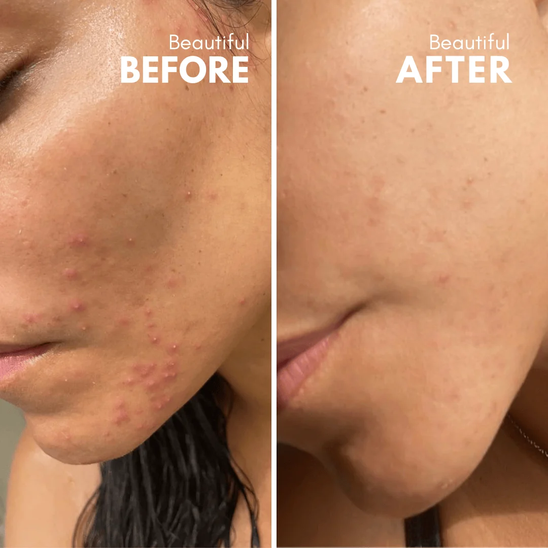 Apokathario | Natural Exfoliator - Image 5